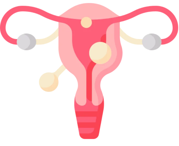 Fibroid & Adenomyosis
