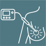 Ablation