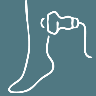 Radiofrequency Ablation Therapy (RFA)