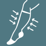 Conservative Vein Treatment