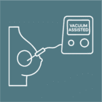 Vacuum